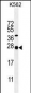 GAL Antibody (Center)